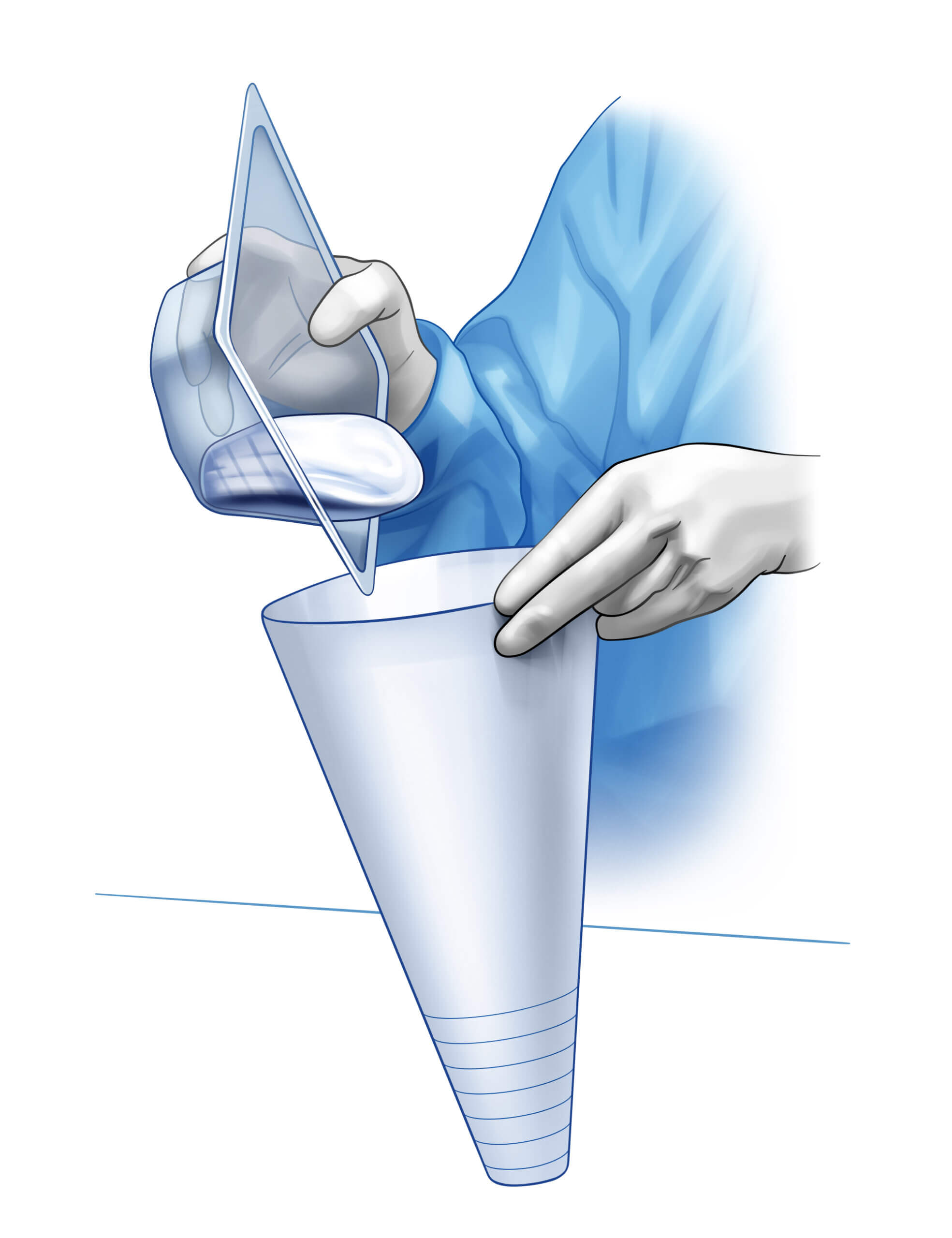 Breast Implant Funnel