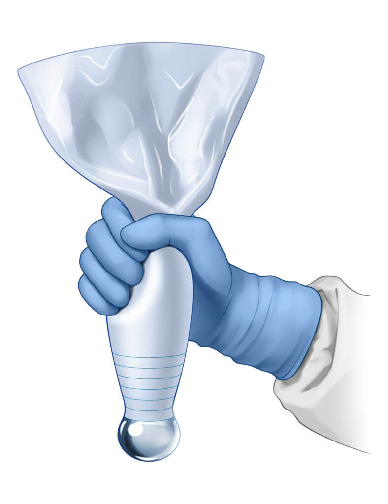 What is the Keller Funnel Technique for Breast Augmentation?