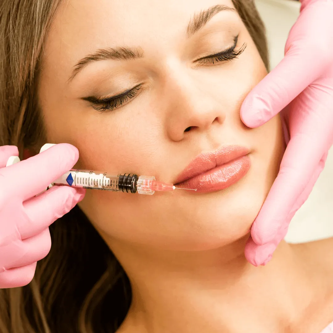 Lip filler for lip enhancement in Scottsdale, Arizona.